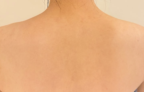 After Image
