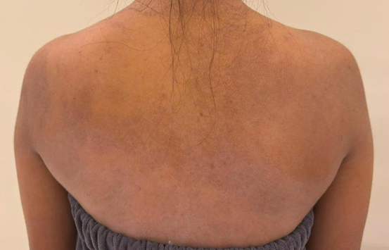After Image