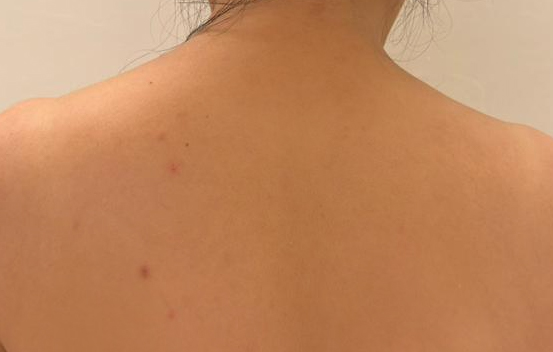 Before Image