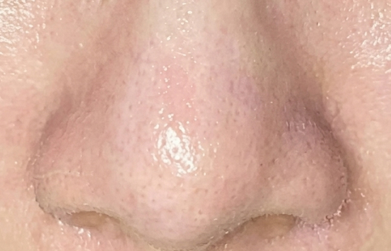 After Image