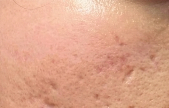Before Image