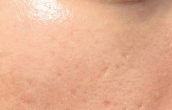After Image