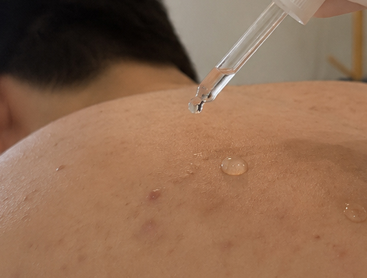 Skin Refining Treatment