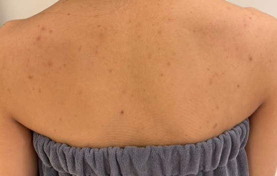Before Image