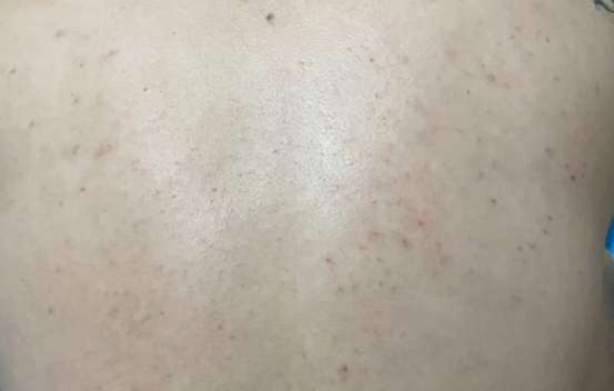 Before Image