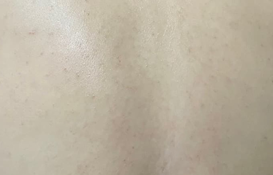 After Image