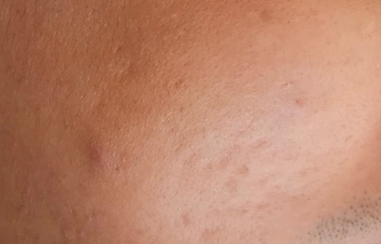 After Image