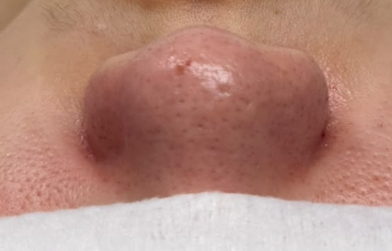 After Image