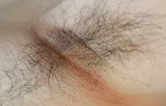 Before Image