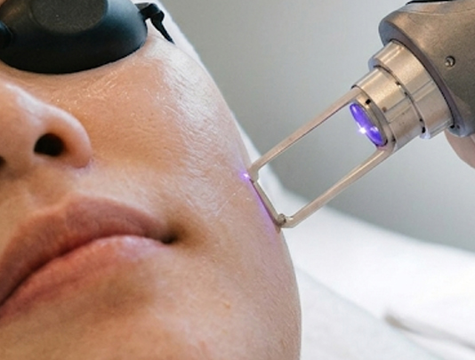 Picosure Laser